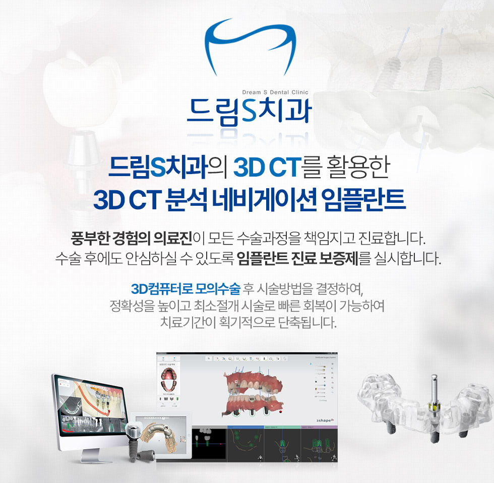 드림S치과의 3D CT를 활용한 3D CT 분석 네비게이션 임플란트