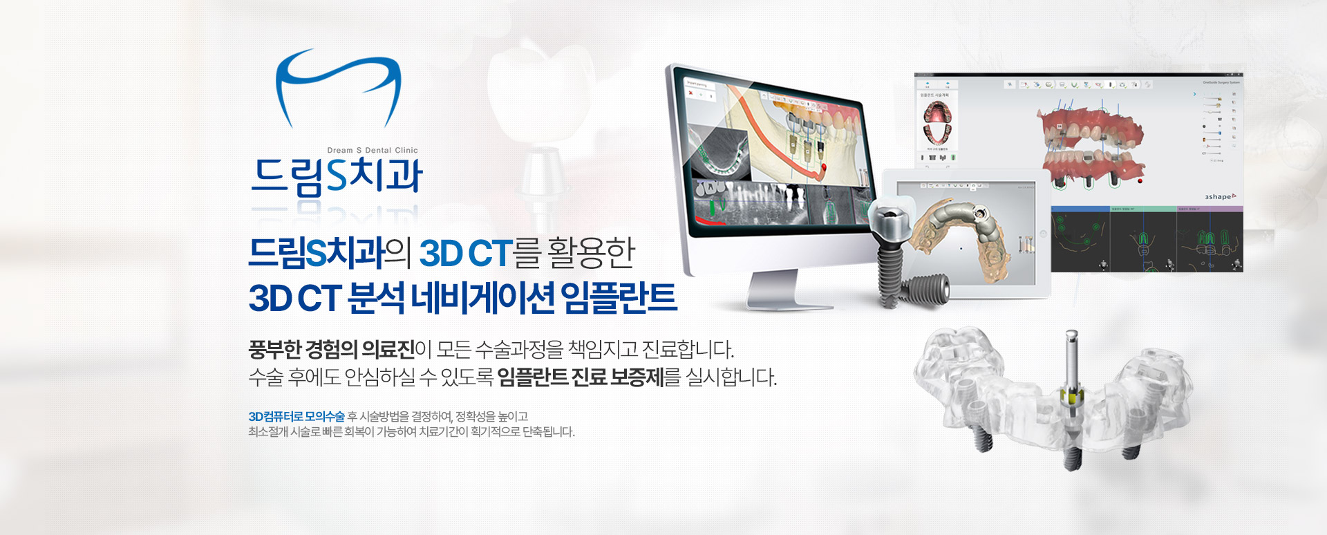 드림S치과의 3D CT를 활용한 3D CT 분석 네비게이션 임플란트